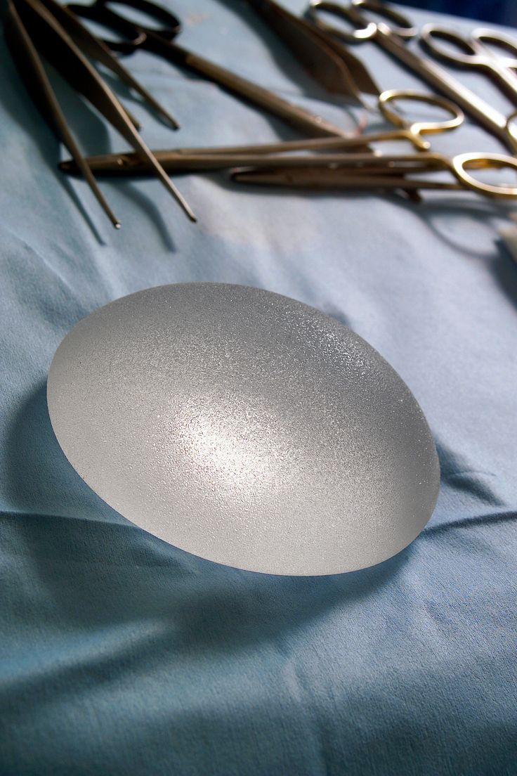 Dr. Žygimantas Mačys holding breast implants, preparing for a surgery with careful attention to detail.